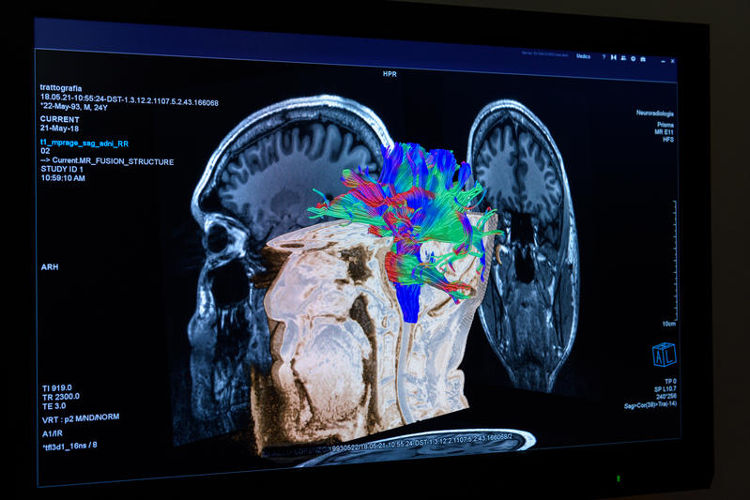 ricerca scientifica - risonanza magnetica