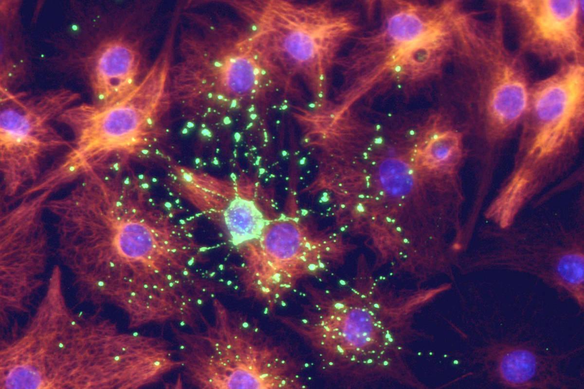 Neuroriabilitazione Neuroriabilitazione