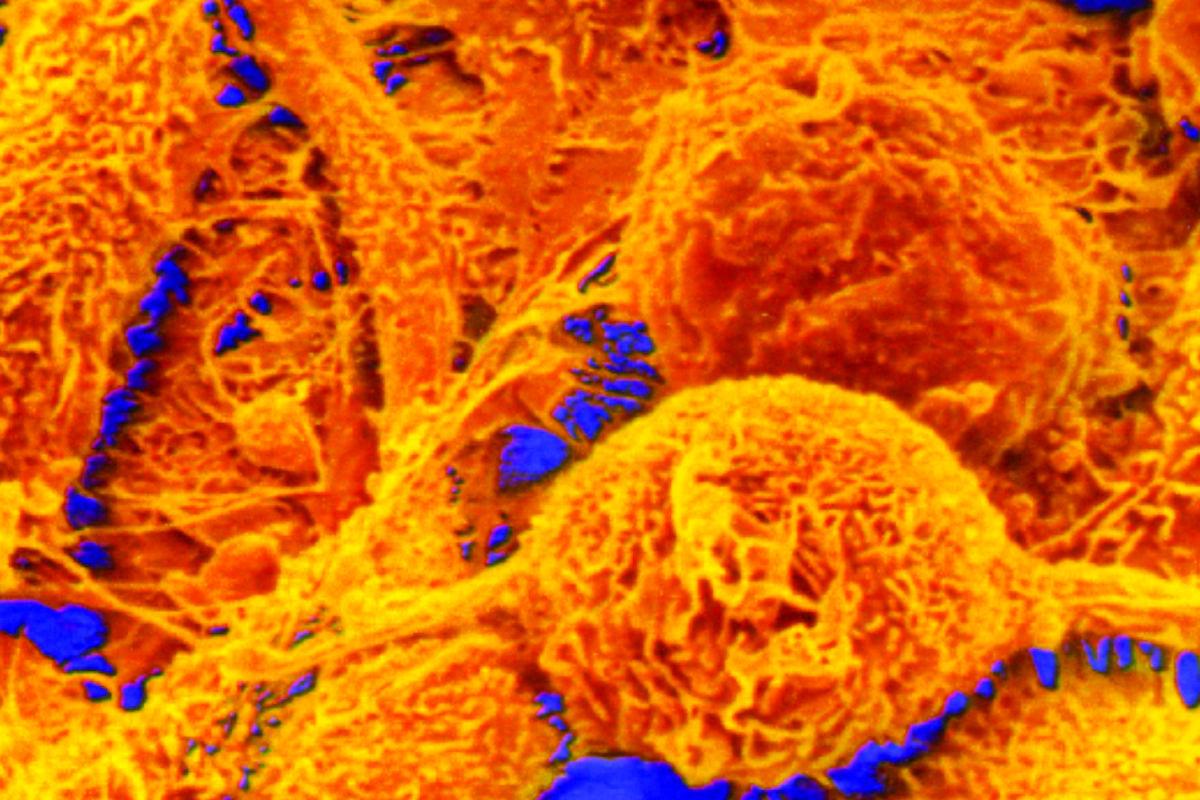 Programmi speciali cellule staminali Programmi speciali cellule staminali