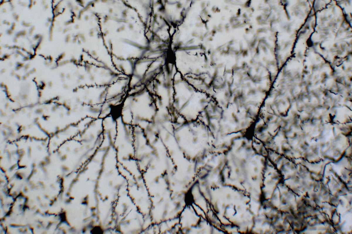 neuroni neuroni